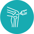 Cartilage Injection